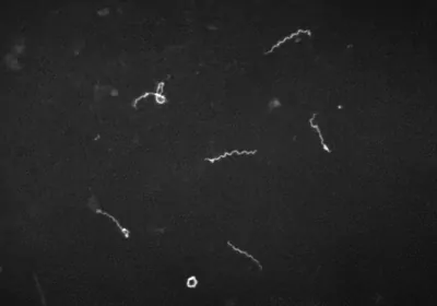 white squiggles on black background